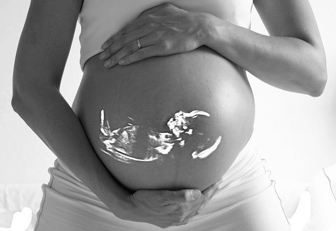 15 странных вопросов, которые до сих пор гуглят беременные